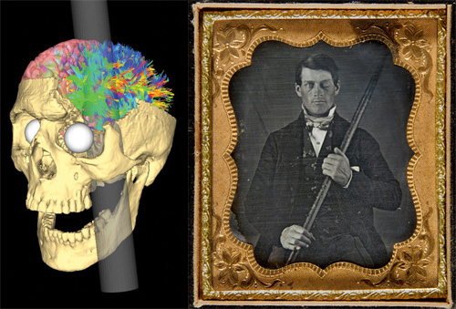 Phineas Gage