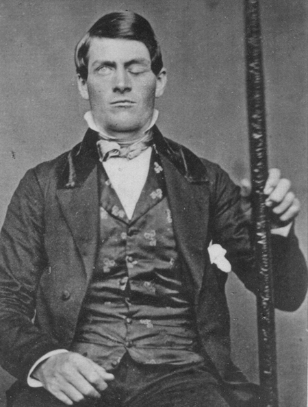 Phineas Gage